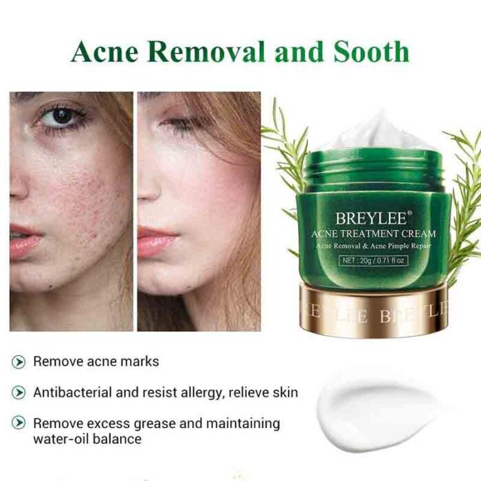 BREYLEE Acne Treatment Cream Anti Acne Face Cream - Image 1