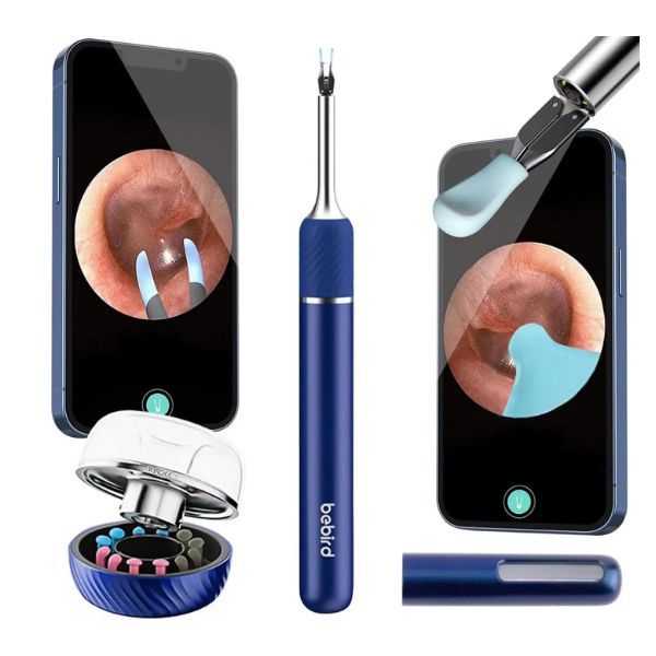 Bebird-Note5-Pro-Ear-Wax-Removal-Tool-Camera-Ear-Cleaner-with-Light.jpg Bebird Note5 Pro Ear Wax Removal Tool Camera Ear Cleaner with Light - Image 1